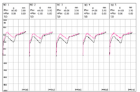 Load image into Gallery viewer, MOMOKA Shark Tactile Switch
